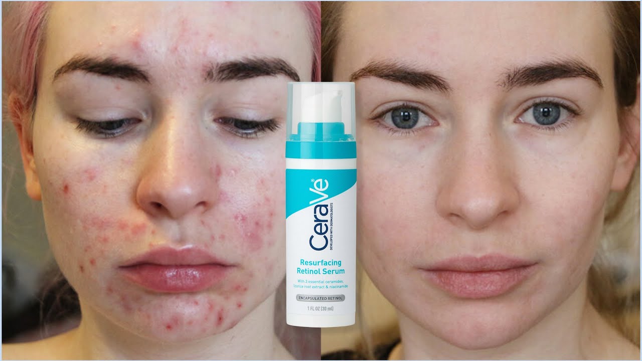 CeraVe Resurfacing Rational Serum